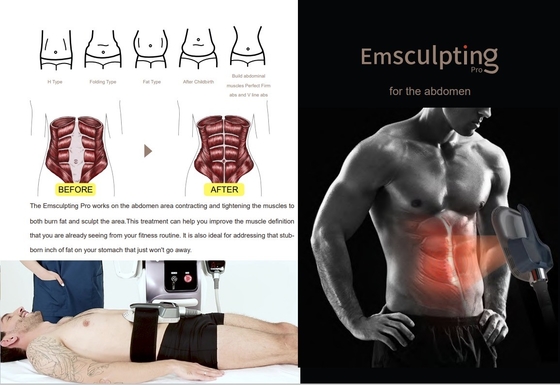 वाणिज्यिक ईएमएस स्लिमिंग मशीन सौंदर्य सैलून / स्पा के लिए 10 इंच टच स्क्रीन